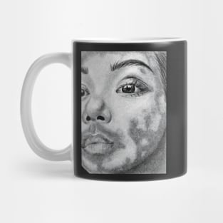 drawing insecurities acne pimples body positivity Mug